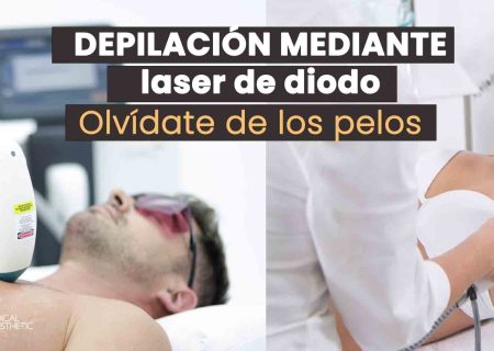 depilacion-laser-diodo-hombre-mujer-barcelona